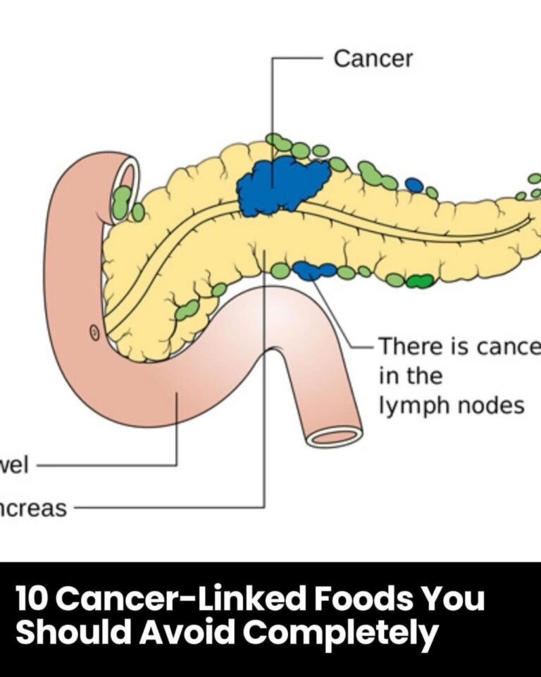 10 Cancer-Linked Foods You Should Never Put in Your Mouth Again